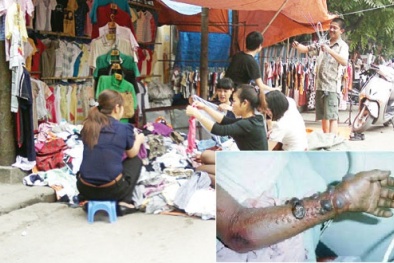 Nguy cơ lây nhiễm Ebola qua quần áo hàng thùng